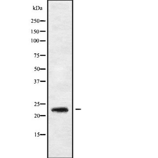 RAB30 Antibody in Western Blot (WB)