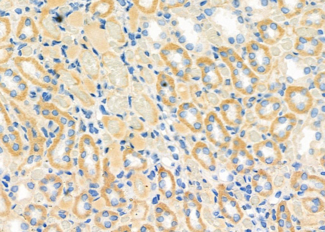 RAB32 Antibody in Immunohistochemistry (Paraffin) (IHC (P))