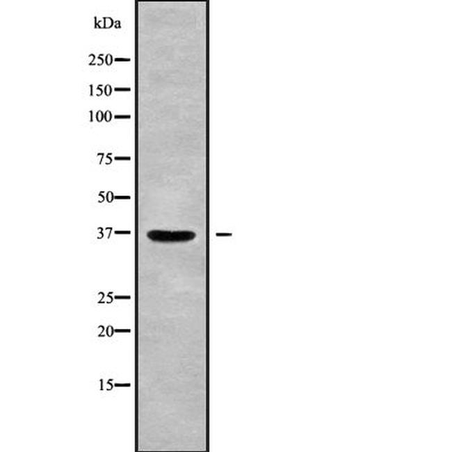 RAB36 Antibody in Western Blot (WB)