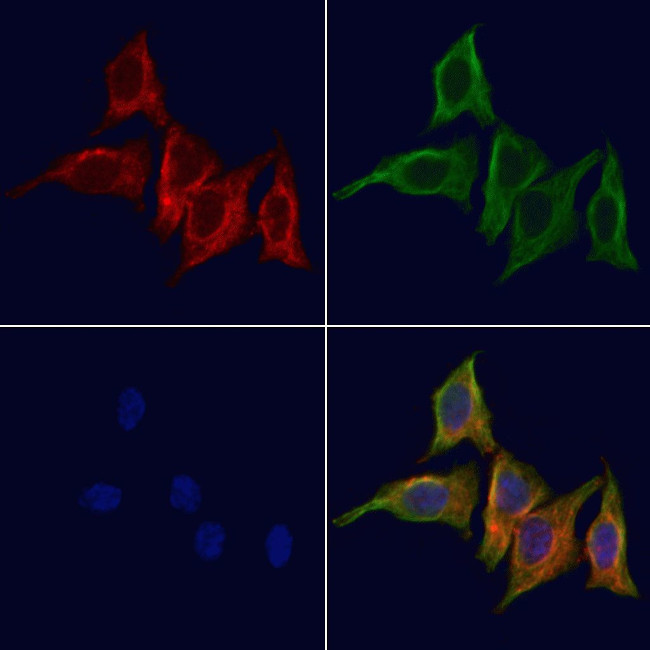 RAB39A Antibody in Immunocytochemistry (ICC/IF)