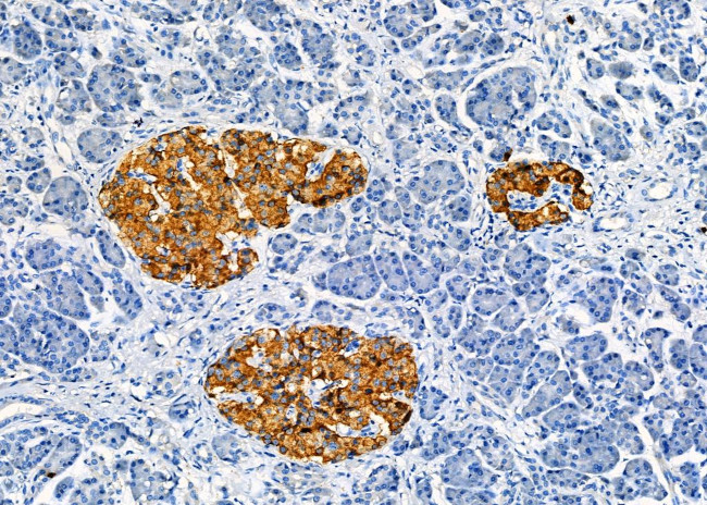 RAB40AL Antibody in Immunohistochemistry (Paraffin) (IHC (P))