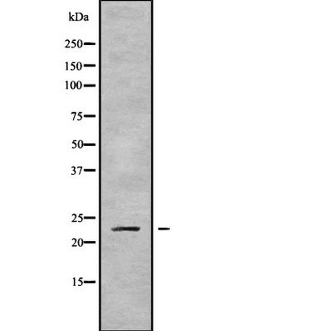 RAB43 Antibody in Western Blot (WB)