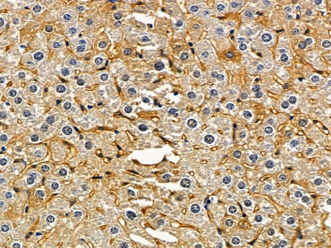 RAB5B Antibody in Immunohistochemistry (Paraffin) (IHC (P))