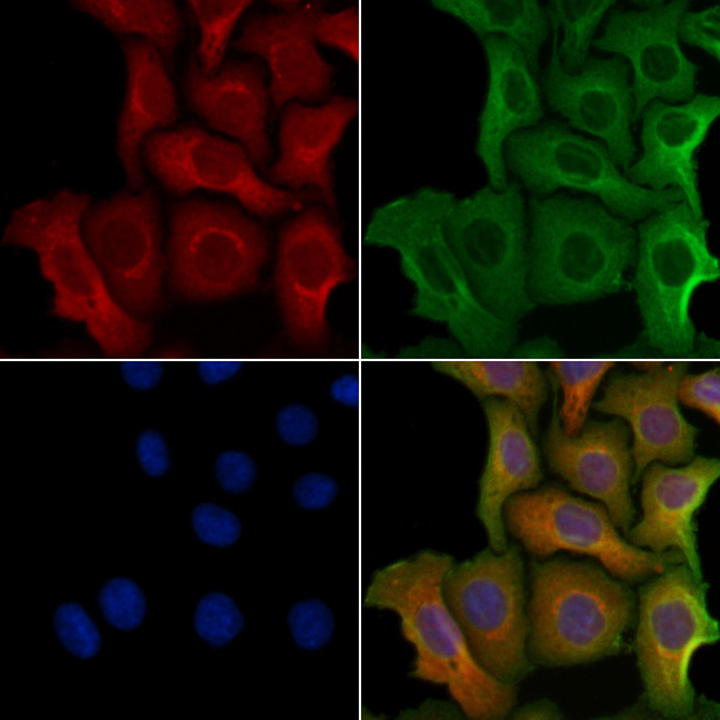 RAB9B Antibody in Immunocytochemistry (ICC/IF)