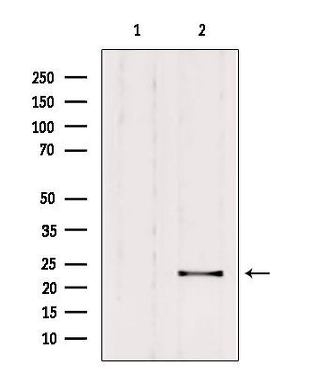 RAB9B Antibody in Western Blot (WB)