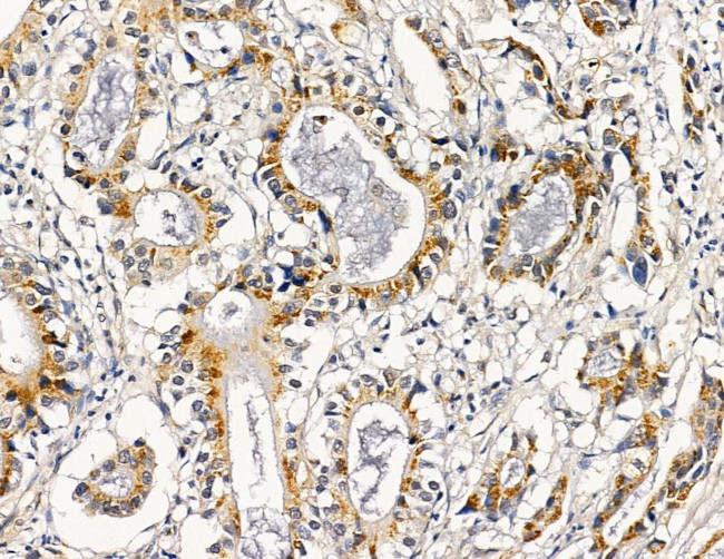 RRAS2 Antibody in Immunohistochemistry (Paraffin) (IHC (P))