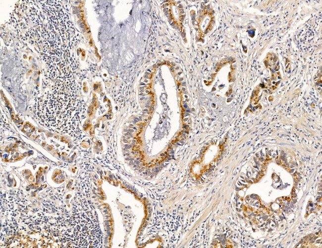 RRAS2 Antibody in Immunohistochemistry (Paraffin) (IHC (P))