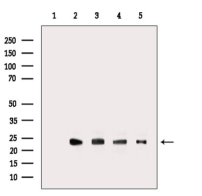 RRAS2 Antibody in Western Blot (WB)