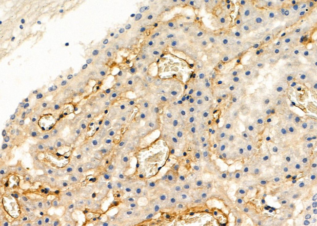 PTPRK Antibody in Immunohistochemistry (Paraffin) (IHC (P))