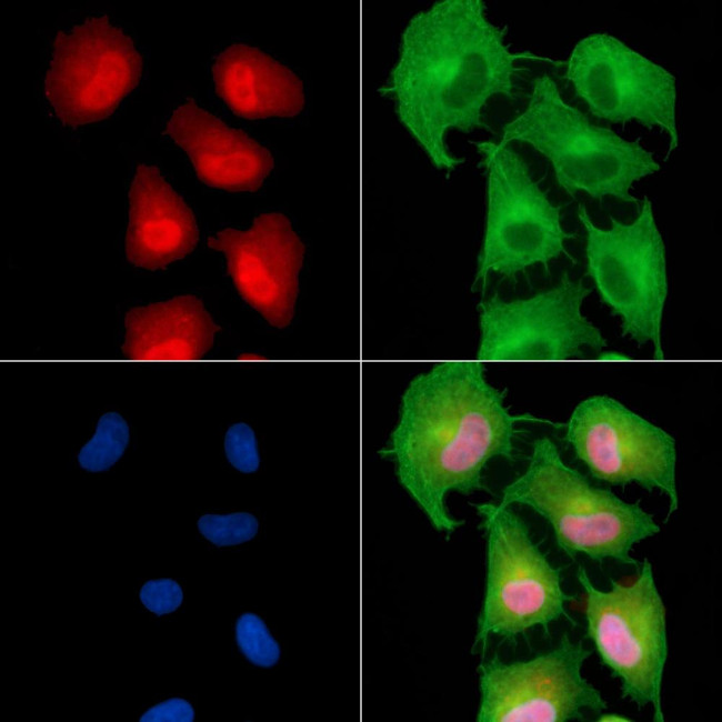 RGS20 Antibody in Immunocytochemistry (ICC/IF)