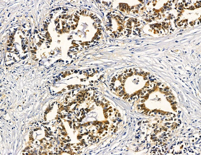 RGS20 Antibody in Immunohistochemistry (Paraffin) (IHC (P))