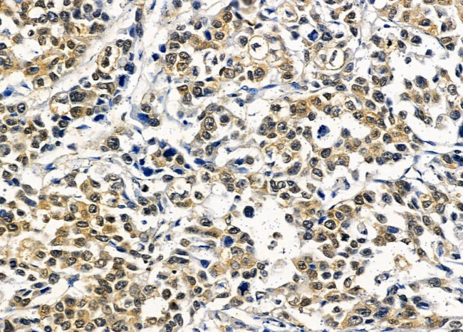 RGS20 Antibody in Immunohistochemistry (Paraffin) (IHC (P))