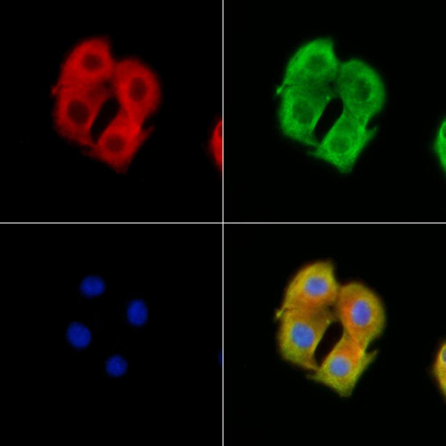 ABCA4 Antibody in Immunocytochemistry (ICC/IF)