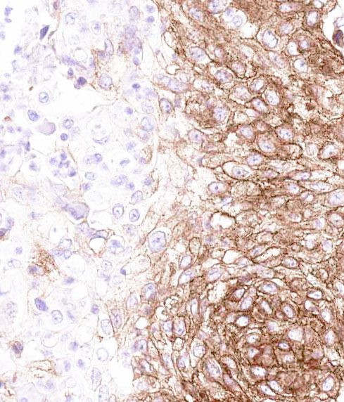 ABCA4 Antibody in Immunohistochemistry (Paraffin) (IHC (P))