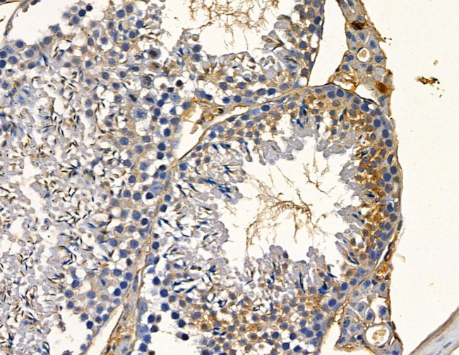 ABCA4 Antibody in Immunohistochemistry (Paraffin) (IHC (P))