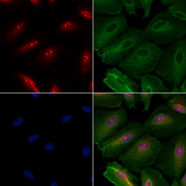 BMS1 Antibody in Immunocytochemistry (ICC/IF)