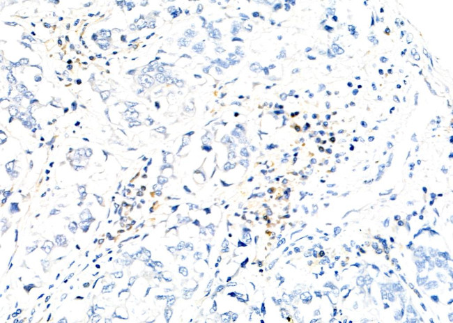 BMS1 Antibody in Immunohistochemistry (Paraffin) (IHC (P))