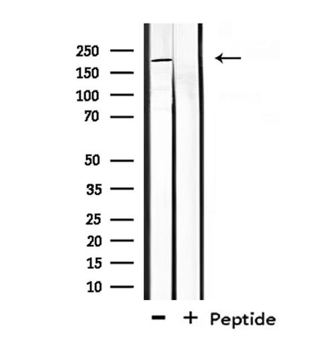 CROCC Antibody in Western Blot (WB)