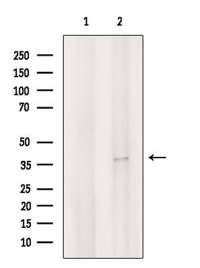 FRZB Antibody in Western Blot (WB)