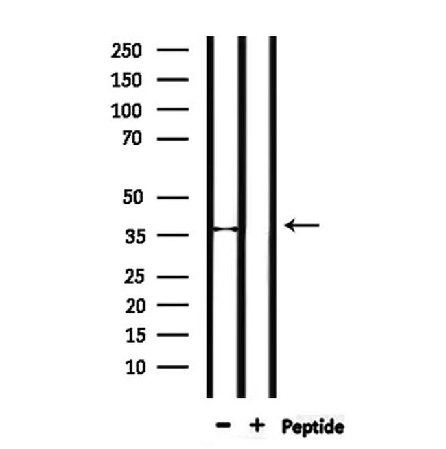 FRZB Antibody in Western Blot (WB)