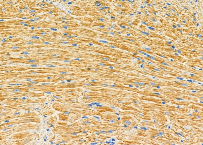 SRR Antibody in Immunohistochemistry (Paraffin) (IHC (P))