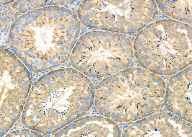 SRR Antibody in Immunohistochemistry (Paraffin) (IHC (P))