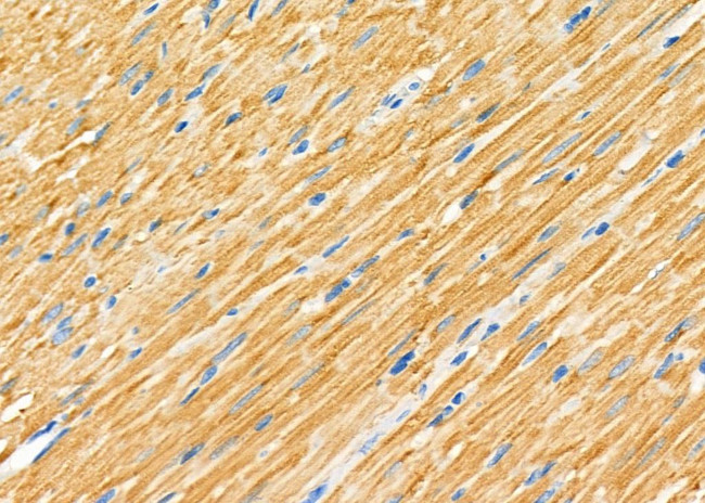 SRR Antibody in Immunohistochemistry (Paraffin) (IHC (P))