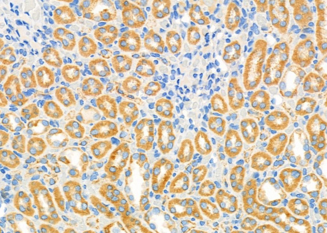 SRR Antibody in Immunohistochemistry (Paraffin) (IHC (P))