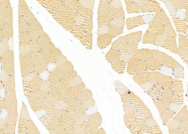 SRR Antibody in Immunohistochemistry (Paraffin) (IHC (P))