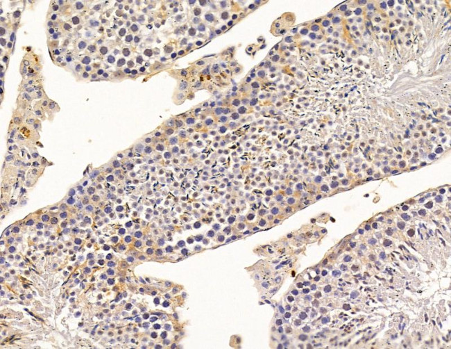 SCML2 Antibody in Immunohistochemistry (Paraffin) (IHC (P))