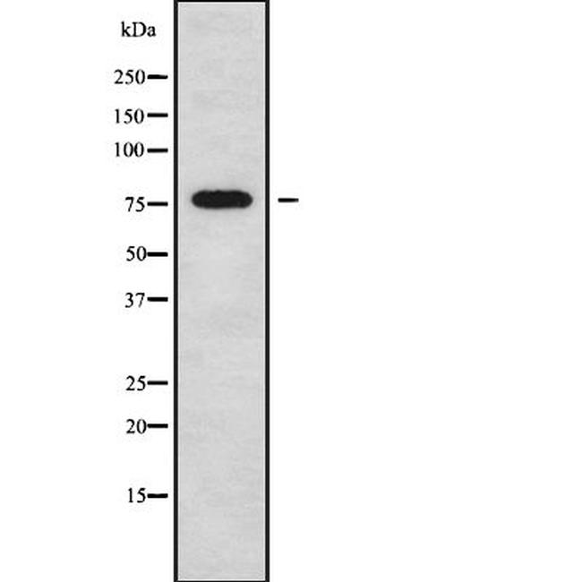 SCML2 Antibody in Western Blot (WB)