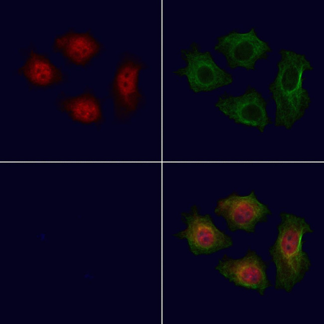 LNK Antibody in Immunocytochemistry (ICC/IF)