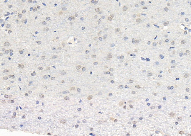 LNK Antibody in Immunohistochemistry (Paraffin) (IHC (P))