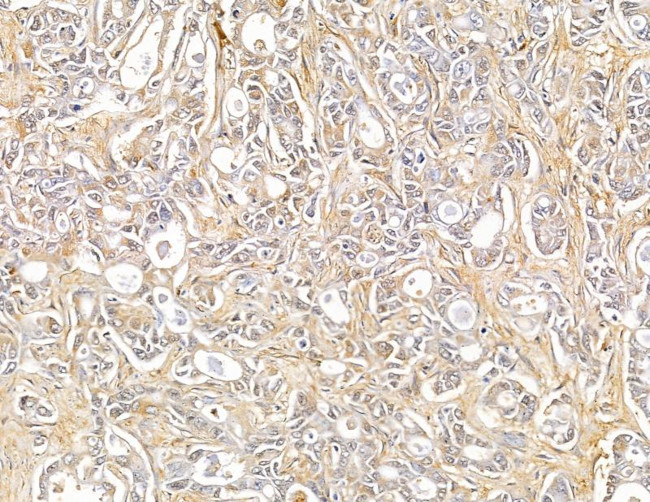 SH3PXD2A Antibody in Immunohistochemistry (Paraffin) (IHC (P))