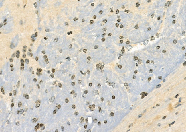 SH3BGRL2 Antibody in Immunohistochemistry (Paraffin) (IHC (P))