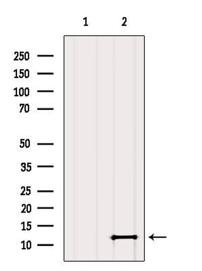 SH3BGRL2 Antibody in Western Blot (WB)