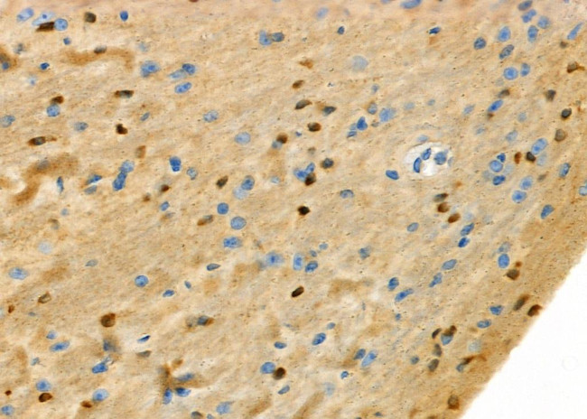 SH3BGRL3 Antibody in Immunohistochemistry (Paraffin) (IHC (P))