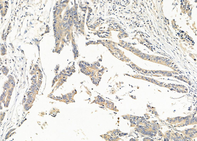 SLIT3 Antibody in Immunohistochemistry (Paraffin) (IHC (P))