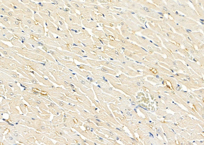 SLIT3 Antibody in Immunohistochemistry (Paraffin) (IHC (P))