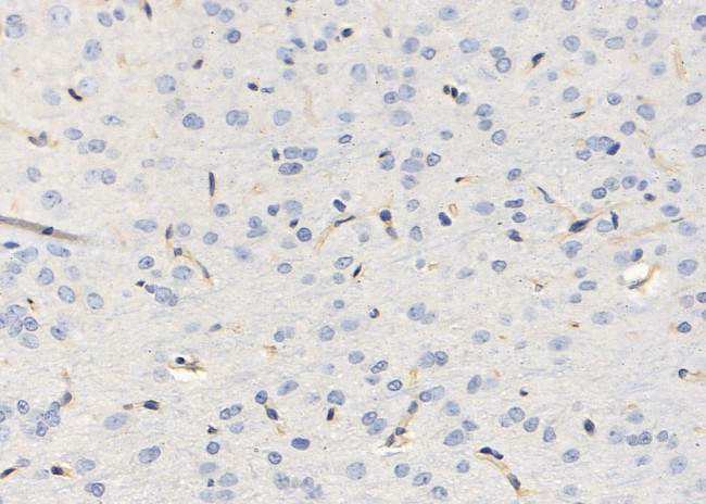 SLIT3 Antibody in Immunohistochemistry (Paraffin) (IHC (P))