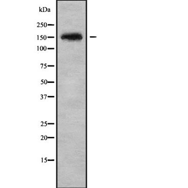 SLIT3 Antibody in Western Blot (WB)