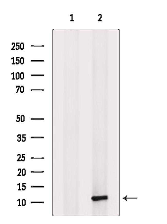 MCP-4 Antibody in Western Blot (WB)