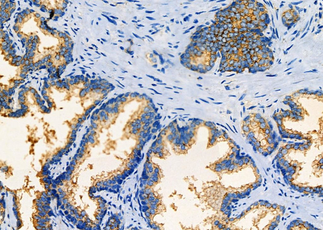 Eotaxin 3 Antibody in Immunohistochemistry (Paraffin) (IHC (P))