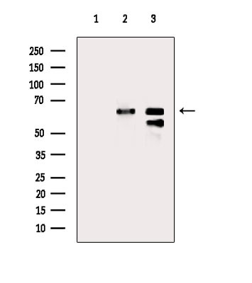 SLC6A12 Antibody in Western Blot (WB)