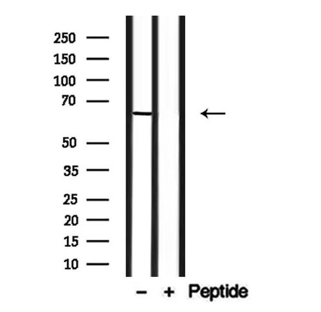 SLC6A13 Antibody in Western Blot (WB)