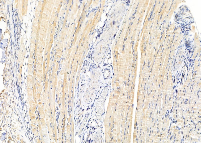 SLC4A7 Antibody in Immunohistochemistry (Paraffin) (IHC (P))