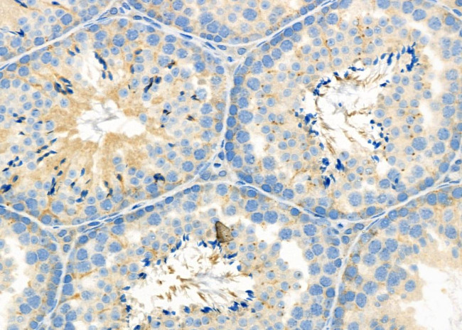 SLC9A10 Antibody in Immunohistochemistry (Paraffin) (IHC (P))