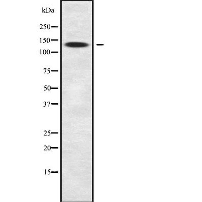 SLC9A11 Antibody in Western Blot (WB)