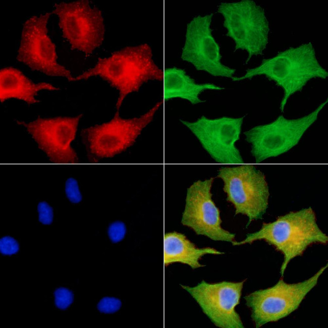 SLC28A1 Antibody in Immunocytochemistry (ICC/IF)