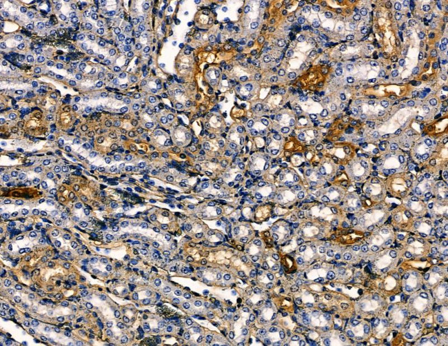 SLC28A1 Antibody in Immunohistochemistry (Paraffin) (IHC (P))